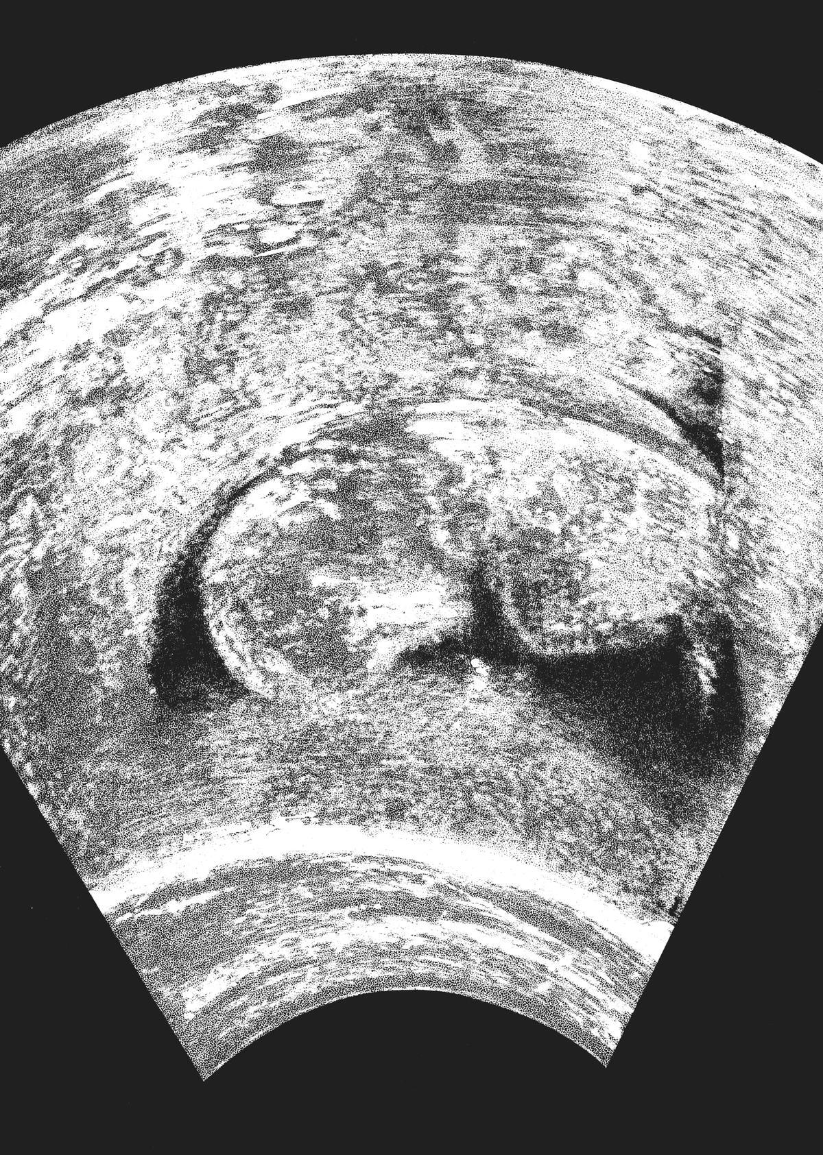 Read Homunculus (en) Manga Online