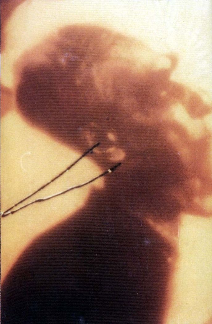 Read Sandman (pt) Manga Online