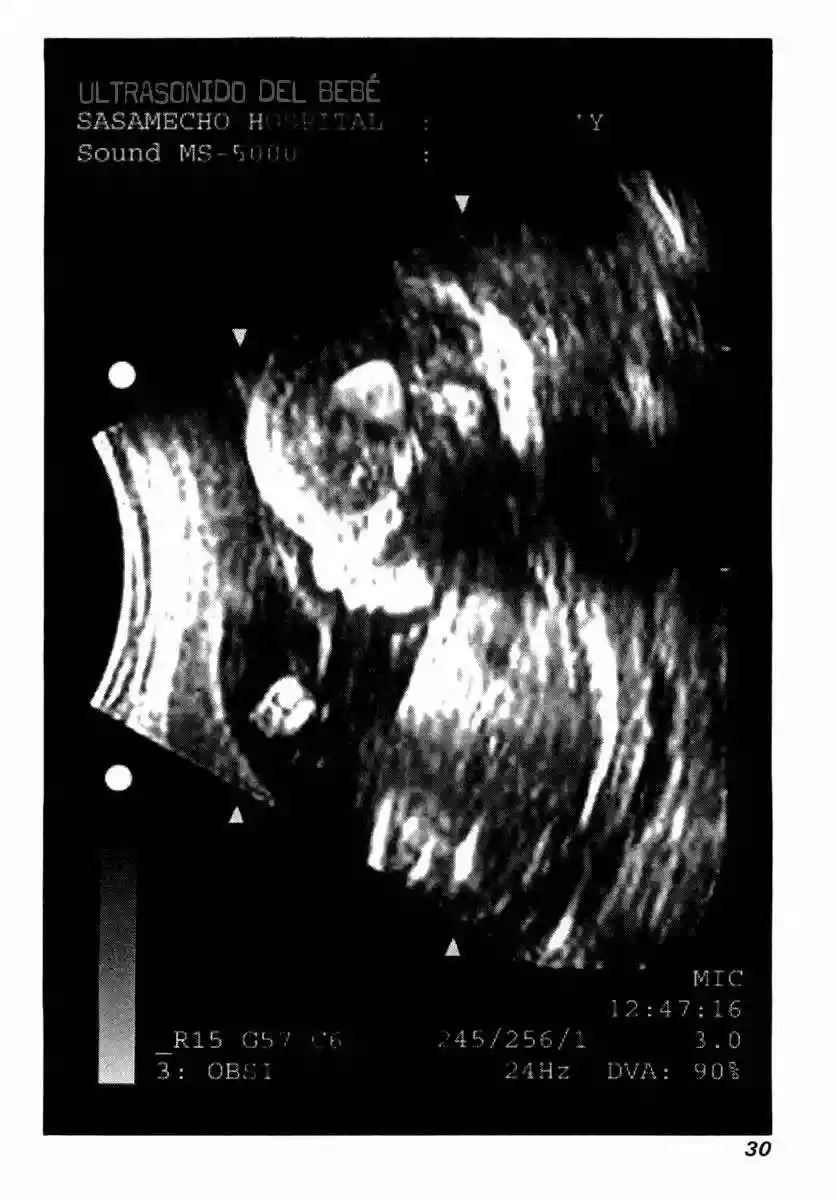 Read Elfen Lied (es) Manga Online