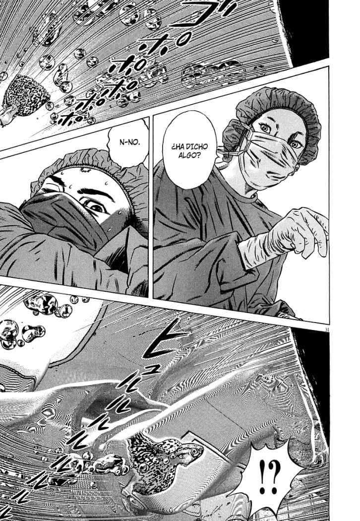 Read Homunculus (es) Manga Online