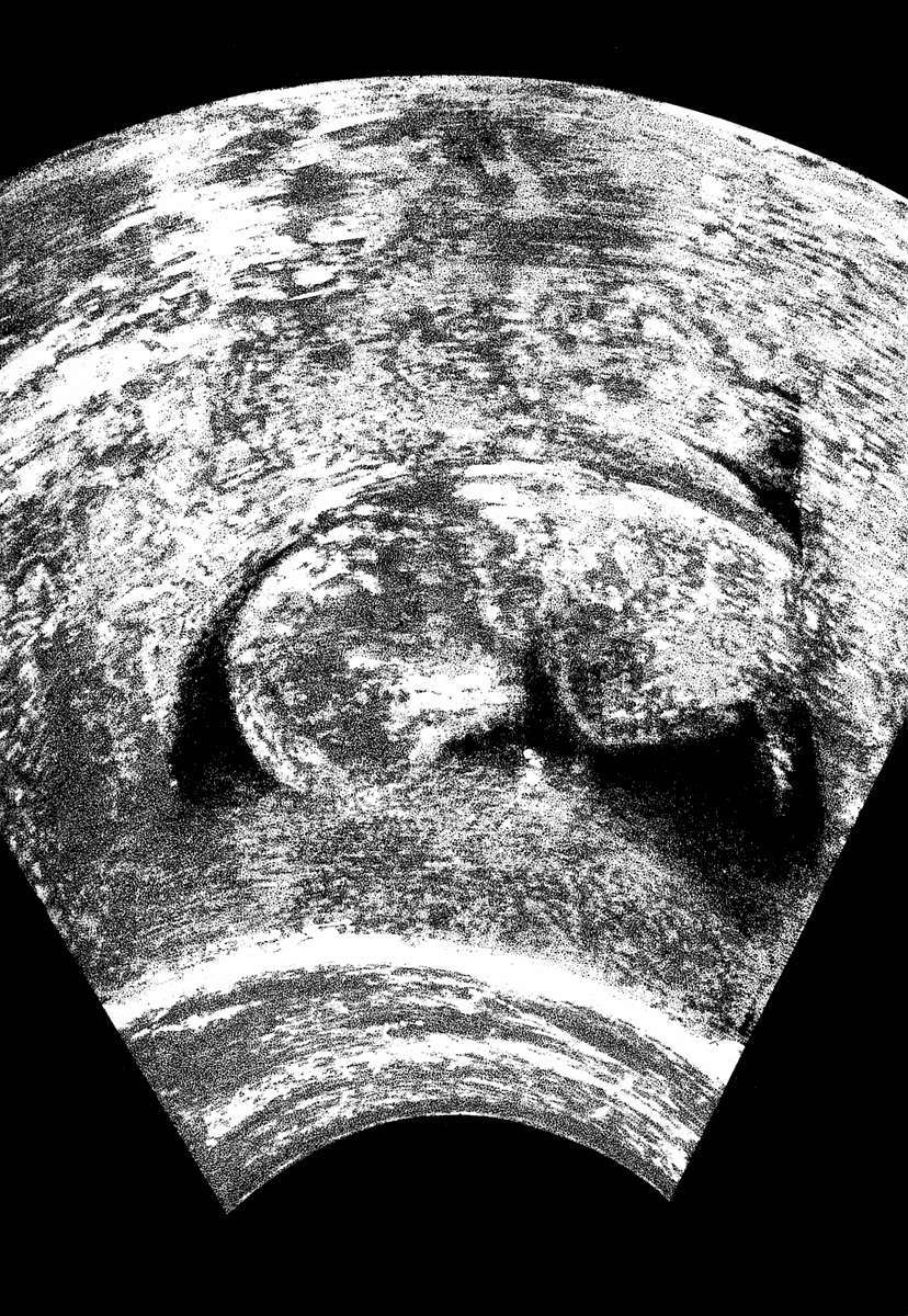 Read Homunculus (es) Manga Online